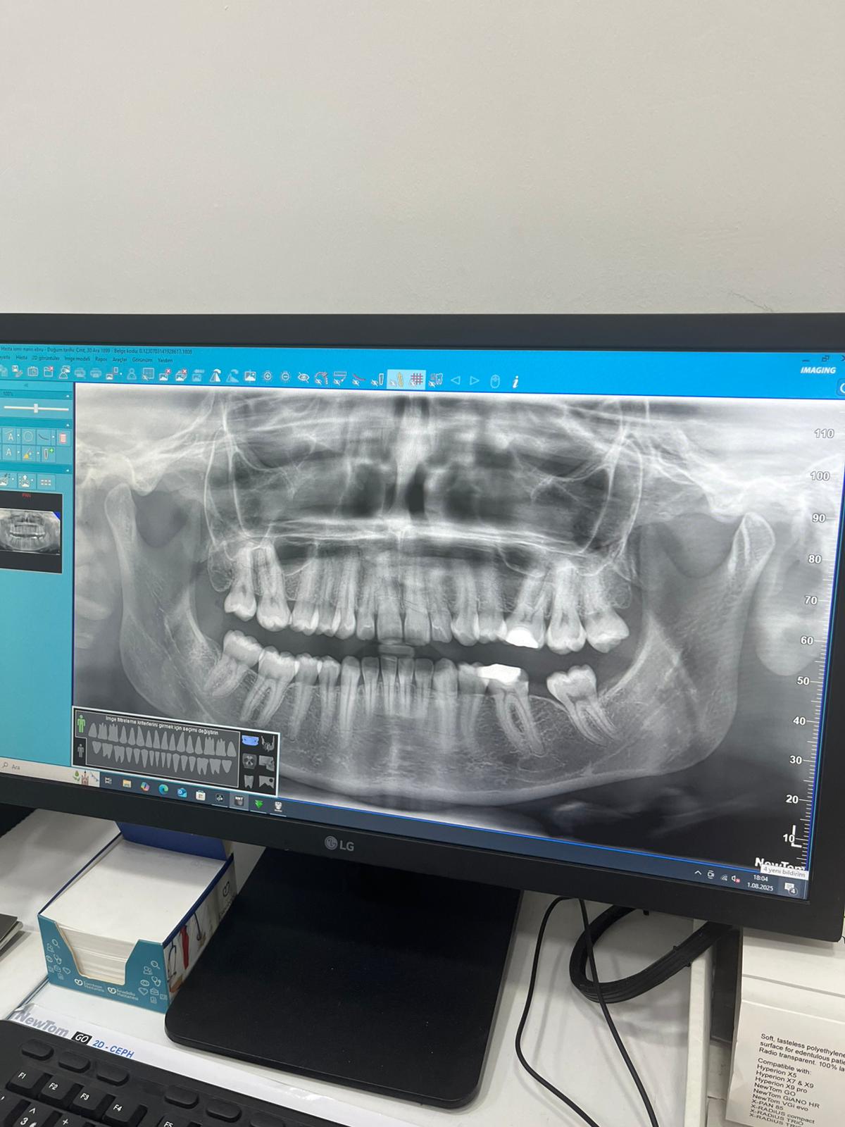 Hasta odaklı iletişim ve konforlu tedavi alanı